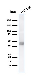 Western Blot Analysis of HCT116 cell lysate using CK8 with Cytokeratin 8 Mouse Monoclonal Antibody (K8.8).