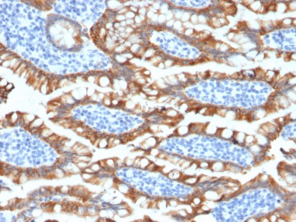 Formalin-fixed, paraffin-embedded human Small Intestine stained with Cytokeratin 8 Rabbit Recombinant Monoclonal Antibody (KRT8/2174R).