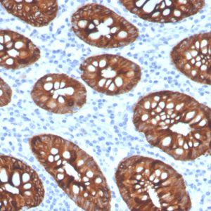 Formalin-fixed, paraffin-embedded human colon stained with Cytokeratin 8 Recombinant Rabbit Monoclonal Antibody (KRT8/4067R).