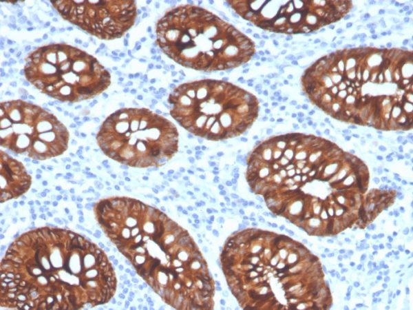 Formalin-fixed, paraffin-embedded human colon stained with Cytokeratin 8 Recombinant Rabbit Monoclonal Antibody (KRT8/4067R).