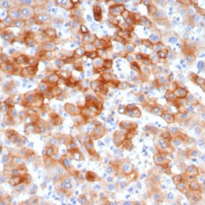 Formalin-fixed, paraffin-embedded human colon stained with Cytokeratin 8 Recombinant Rabbit Monoclonal Antibody (KRT8/6472R).