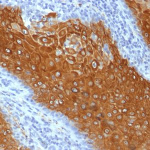 Formalin-fixed, paraffin-embedded human Skin stained with Cytokeratin 10 Mouse Monoclonal Antibody (KRT10/844).