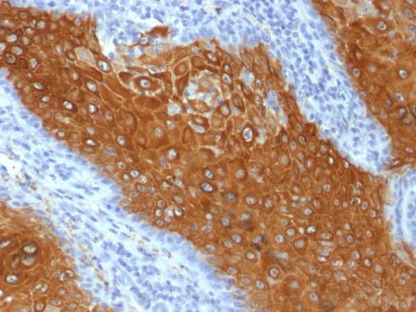 Formalin-fixed, paraffin-embedded human Skin stained with Cytokeratin 10 Mouse Monoclonal Antibody (KRT10/844).