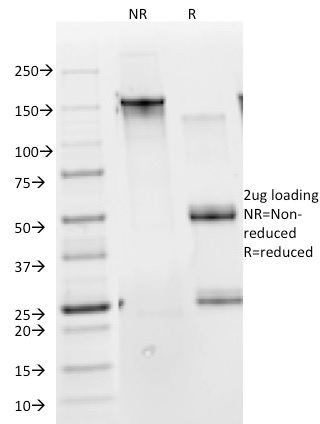 SDS-PAGE Analysis of Purified Cytokeratin 10 Monoclonal Antibody (DE-K10). Confirmation of Integrity and Purity of Antibody