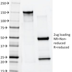 SDS-PAGE Analysis of Purified Cytokeratin 10 Mouse Monoclonal Antibody (AE20). Confirmation of Purity and Integrity of Antibody.