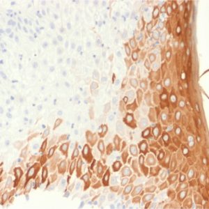 Formalin-fixed, paraffin-embedded human skin stained with Cytokeratin 10 Recombinant Mouse Monoclonal Antibody (rKRT10/1275).