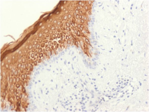 Formalin-fixed, paraffin-embedded human skin stained with Cytokeratin 10 Rabbit Recombinant Monoclonal Antibody (KRT10/1948R).