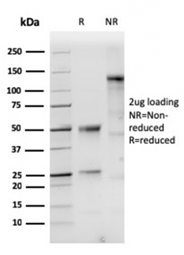 SDS-PAGE Analysis of Purified Cytokeratin 10 Rabbit Recombinant Monoclonal Antibody (KRT10/1948R).