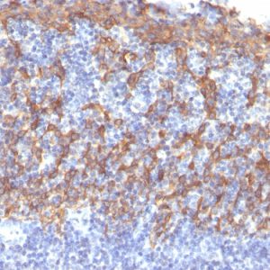 Formalin-fixed, paraffin-embedded human Tonsil stained with Cytokeratin 14 Mouse Monoclonal Antibody (LL002).