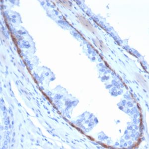 Formalin-fixed, paraffin-embedded human prostate stained with Cytokeratin 14 Mouse Monoclonal Antibody (KRT14/4132).