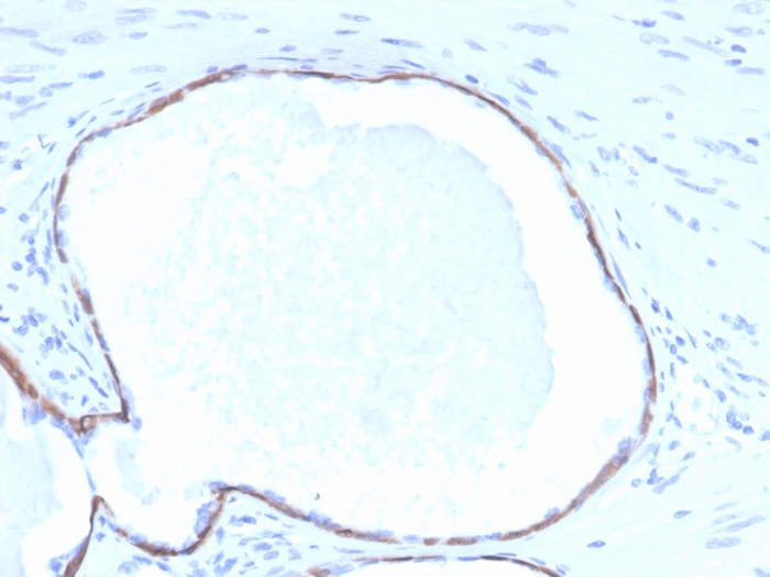 Formalin-fixed, paraffin-embedded human prostate stained with Cytokeratin 14 Mouse Monoclonal Antibody (KRT14/4132). Cytokeratin 14 (KRT14) (Squamous Cell Marker) Antibody - Image 2