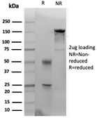 SDS-PAGE Analysis of Purified Cytokeratin 14 Mouse Monoclonal Antibody (KRT14/4133). Confirmation of Purity and Integrity of Antibody. Cytokeratin 14 (KRT14) (Squamous Cell Marker) Antibody - Image 2