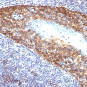 Formalin-fixed, paraffin-embedded human Tonsil stained with Cytokeratin 14 Monoclonal Antibody (KRT14/532).