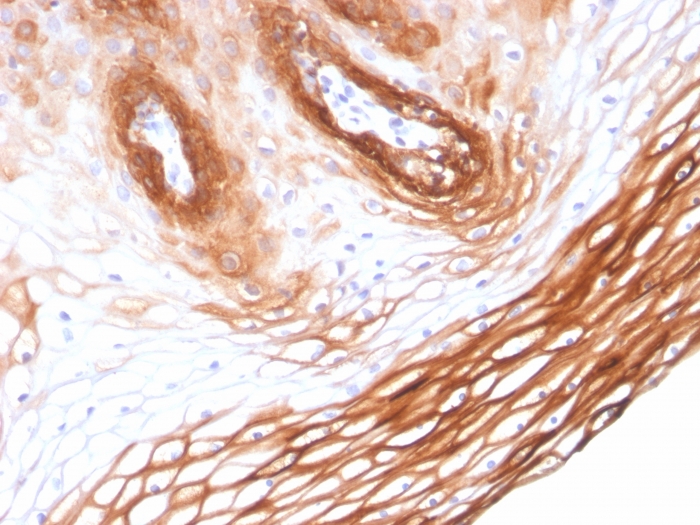 Formalin-fixed, paraffin-embedded human Skin stained with Cytokeratin 14 Mouse Monoclonal Antibody (KRT14/2375). Cytokeratin 14 (KRT14) (Squamous Cell Marker) Antibody - Image 2