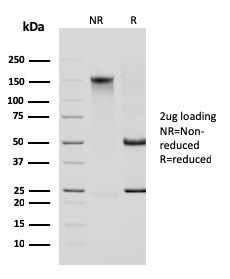 SDS-PAGE Analysis Purified Cytokeratin 14 Mouse Monoclonal Antibody (KRT14/2375). Confirmation of Purity and Integrity of Antibody. Cytokeratin 14 (KRT14) (Squamous Cell Marker) Antibody - Image 3