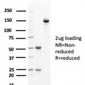 SDS-PAGE Analysis Purified Cytokeratin 14 Mouse Monoclonal Antibody (KRT14/4125). Confirmation of Purity and Integrity of Antibody.