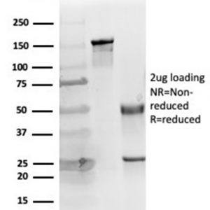 SDS-PAGE Analysis Purified Cytokeratin 14 Mouse Monoclonal Antibody (KRT14/4127). Confirmation of Purity and Integrity of Antibody.