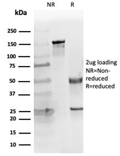 SDS-PAGE Analysis of Purified Cytokeratin 14 Mouse Monoclonal Antibody (KRT14/4127). Confirmation of Purity and Integrity of Antibody. Cytokeratin 14 (KRT14) (Squamous Cell Marker) Antibody