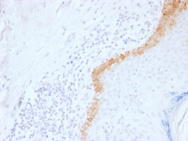 Formalin-fixed, paraffin-embedded human Skin stained with Cytokeratin 15 Mouse Monoclonal Antibody (LHK15).