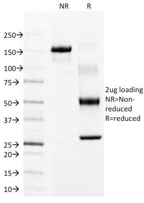 SDS-PAGE Analysis Purified Cytokeratin 15 Mouse Monoclonal Antibody (LHK15). Confirmation of Integrity and Purity of Antibody