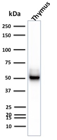 Western Blot Analysis of Human Thymus tissue lysate using Cytokeratin 15 Mouse Monoclonal Antibody (KRT15/2957)