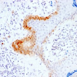 Formalin-fixed, paraffin-embedded human skin stained with Cytokeratin 15 Rabbit Recombinant Monoclonal Antibody (KRT15/2103R).