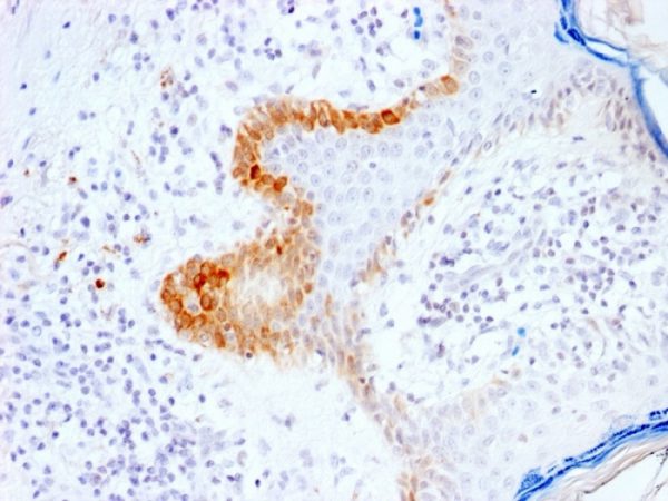 Formalin-fixed, paraffin-embedded human Skin stained with Cytokeratin 15 Rabbit Recombinant Monoclonal Ab (KRT15/2103R).