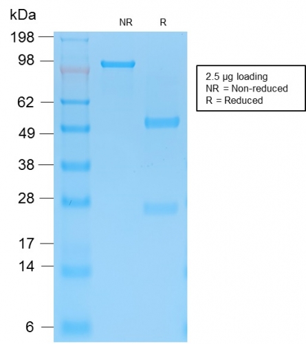 SDS-PAGE Analysis Purified Cytokeratin 15 Rabbit Recombinant Monoclonal Ab (KRT15/2103R). Confirmation of Purity and Integrity of Antibody.