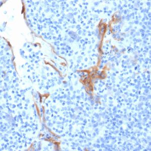 Formalin-fixed, paraffin-embedded human Tonsil stained with Cytokeratin 16 Mouse Monoclonal Antibody (LL025).