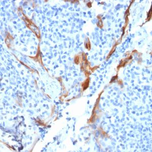 Formalin-fixed, paraffin-embedded human Tonsil stained with Cytokeratin 16 Mouse Monoclonal Antibody (KRT16/1714).