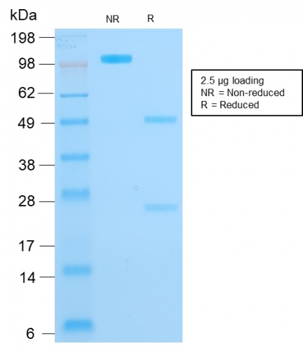 SDS-PAGE Analysis Purified Cytokeratin 16 Mouse Monoclonal Antibody (KRT16/1714). Confirmation of Purity and Integrity of Antibody.