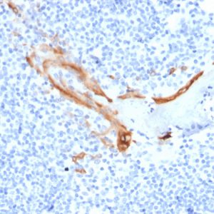 Formalin-fixed, paraffin-embedded human Tonsil stained with Cytokeratin 16 Mouse Monoclonal Antibody (SPM264).