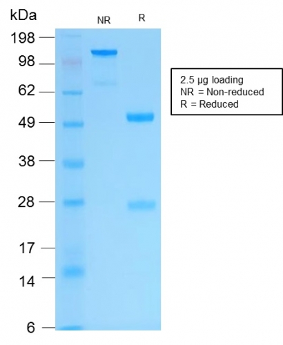 SDS-PAGE Analysis Purified Cytokeratin 16 Rabbit Recombinant Monoclonal Antibody (KRT16/2043R).