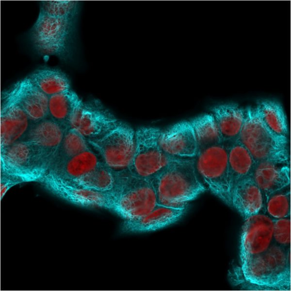 Immunofluorescence Analysis of MCF-7 cells labeling KRT18 with Cytokeratin 18 Rabbit Recombinant MAb (KRT18/2819R followed by Goat anti-Rabbit IgG-CF488 (Cyan). The nuclear counterstain is Reddot (Red)