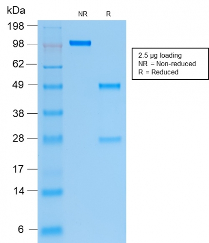 SDS-PAGE Analysis of Purified Cytokeratin 19 Recombinant Mouse Monoclonal Antibody (rKRT19/799). Confirmation of Integrity and Purity of the Antibody.