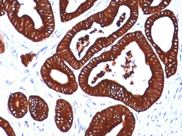 Formalin-fixed, paraffin-embedded human Colon stained with Cytokeratin 19 Mouse Monoclonal Antibody (BA17)