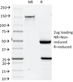 SDS-PAGE Analysis Purified Cytokeratin 19 Mouse Monoclonal Antibody (BA17). Confirmation of Integrity and Purity of Antibody.