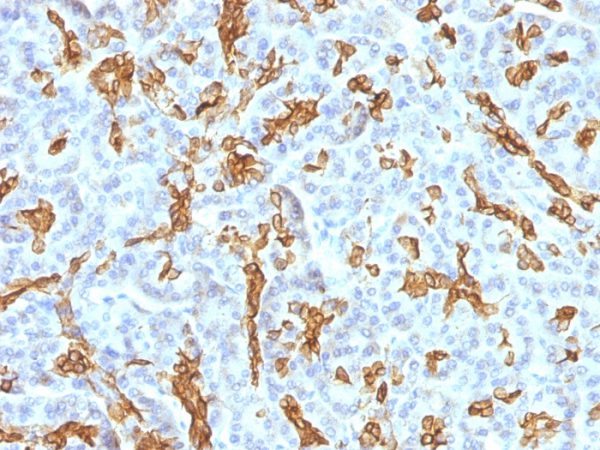 Formalin-fixed, paraffin-embedded human Pancreas stained with Cytokeratin 19 MAb (KRT19/799 + KRT19/800)