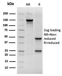 SDS-PAGE Analysis Purified CK19 Mouse Recombinant Monoclonal Antibody (rKRT19/800). Confirmation of Integrity and Purity of Antibody.