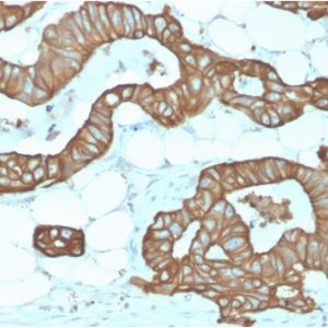 Formalin-fixed, paraffin-embedded human Colon stained with Cytokeratin 19 Rabbit Recombinant Monoclonal Antibody (KRT19/1959R).