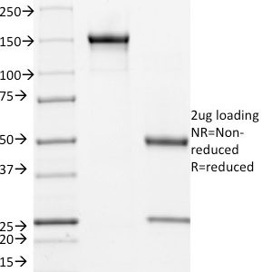 SDS-PAGE Analysis Purified CD171 Mouse Monoclonal Antibody (UJ127). Confirmation of Integrity and Purity of Antibody.