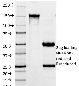 SDS-PAGE Analysis of Purified CD171 Mouse Monoclonal Antibody (SPM275). Confirmation of Integrity and Purity of Antibody.