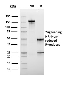SDS-PAGE Analysis Purified Monospecific Mouse Monoclonal Antibody to LAG-3 (LAG3/3261). Confirmation of Integrity and Purity of Antibody.