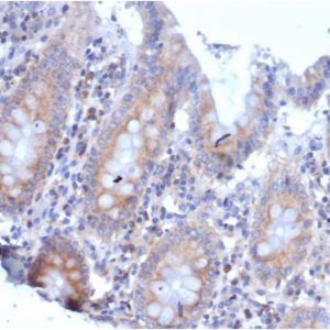 Formalin-fixed, paraffin-embedded human colonstained with Laminin Receptor Recombinant Mouse Monoclonal Antibody (rRPSA/6333).