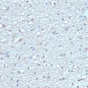Formalin-fixed, paraffin-embedded human brain stained with Leptin Receptor Mouse Monoclonal Antibody (LEPR/4304).