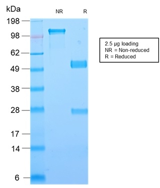 SDS-PAGE Analysis Purified Galectin-1 Monospecific Recombinant Rabbit Monoclonal Antibody (GAL1/2499R). Confirmation of Purity and Integrity of Antibody.