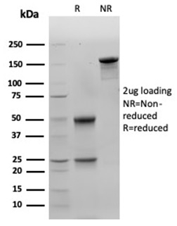 SDS-PAGE Analysis of Purified Galectin-3 Mouse Monoclonal Antibody (LGALS3/4792). Confirmation of Purity and Integrity of Antibody.