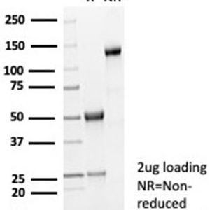 SDS-PAGE Analysis of Purified LGALS3 Rabbit Recombinant Monoclonal Antibody (LGALS3/7036R). Confirmation of Purity and Integrity of Antibody.