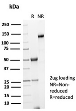 SDS-PAGE Analysis Purified LGALS3 Rabbit Recombinant Monoclonal Antibody (LGALS3/7036R). Confirmation of Purity and Integrity of Antibody.