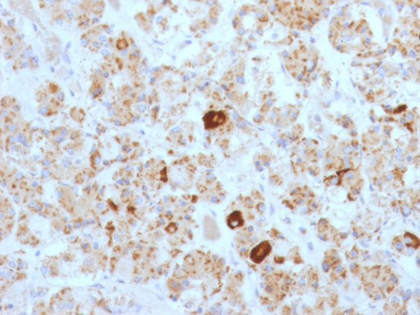 Formalin-fixed, paraffin-embedded human Pituitary stained with LH-beta Mouse Monoclonal Antibody (SPM103